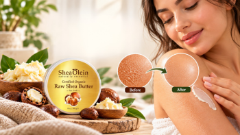 Shea Butter for Dry Skin: Benefits, Drawbacks and Best Uses
